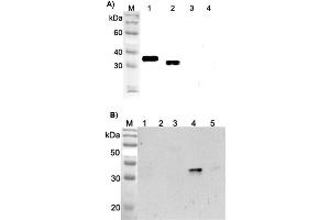 Western blot analysis using anti-ANGPTL4 (FLD) (human), pAb  at 1:2'000 dilution. (ANGPTL4 antibody  (Fibrinogen-like Domain))