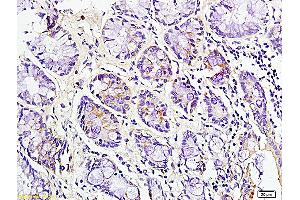 Formalin-fixed and paraffin embedded mouse intestine labeled with Rabbit Anti CD163 Polyclonal Antibody, Unconjugated (ABIN741570) at 1:200 followed by conjugation to the secondary antibody and DAB staining