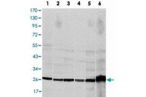 Western blot analysis using CASP8 monoclonal antibody, clone 1H11  against HeLa (1), Jurkat (2), THP-1 (3), NIH/3T3 (4), COS-7 (5) and PC-12 (6) cell lysate. (Caspase 8 antibody)