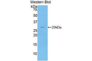 Western blot analysis of the recombinant protein. (DNASE1 antibody  (AA 19-259))