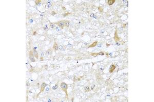 Immunohistochemistry of paraffin-embedded rat brain using CBR4 antibody at dilution of 1:100 (x40 lens). (CBR4 antibody)