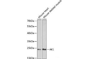 Western blot analysis of extracts of various cell lines using AK1 Polyclonal Antibody at dilution of 1:1000. (Adenylate Kinase 1 antibody)