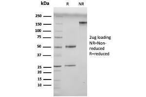 SDS-PAGE Analysis Purified N-Cadherin Mouse Monoclonal Antibody (13A9). (N-Cadherin antibody  (Cytoplasmic Domain))