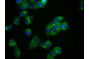Immunofluorescence staining of HepG2 cells with ABIN7174072 at 1:100, counter-stained with DAPI. (ROR2 antibody  (AA 752-926))