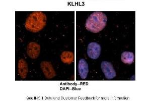 Sample Type : Human brain stem cells Primary Antibody Dilution : 1:500 Secondary Antibody : Goat anti-rabbit Alexa-Fluor 594 Secondary Antibody Dilution : 1:1000 Color/Signal Descriptions : KLHL3: Red DAPI:Blue Gene Name : KLHL3 Submitted by : Dr. (KLHL3 antibody  (N-Term))