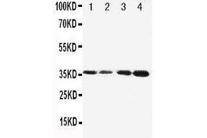 Anti-Protein C antibody, Western blotting Lane 1: JURKAT Cell Lysate Lane 2: CEM Cell Lysate Lane 3: SMMC Cell Lysate Lane 4: HELA Cell Lysate
