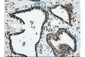 Immunohistochemical staining of paraffin-embedded lung tissue using anti-BSG mouse monoclonal antibody. (CD147 antibody)