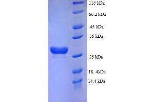 SDS-PAGE (SDS) image for Cholinergic Receptor, Muscarinic 3 (CHRM3) (AA 253-492) protein (His tag) (ABIN5713360) (CHRM3 Protein (AA 253-492) (His tag))