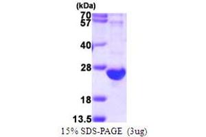 SDS-PAGE (SDS) image for Complement Component 8, gamma Polypeptide (C8G) (AA 21-202) protein (His tag) (ABIN667575) (C8G Protein (AA 21-202) (His tag))