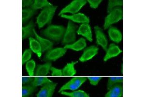 Immunofluorescence analysis of A549 cells using IFNA1 Polyclonal Antibody (IFNA1 antibody)
