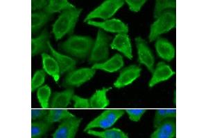 Immunofluorescence analysis of A549 cells using IFNA1 Polyclonal Antibody (IFNA1 antibody)