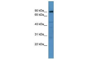 Western Blot showing Adam22 antibody used at a concentration of 1-2 ug/ml to detect its target protein. (ADAM22 antibody  (N-Term))