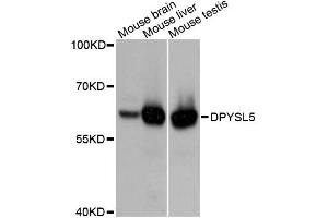 Western blot analysis of extracts of various cell lines, using DPYSL5 antibody (ABIN4903380) at 1:3000 dilution.