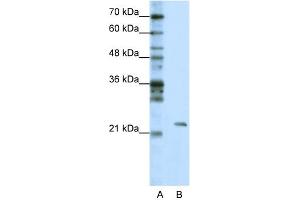 WB Suggested Anti-MRM1 Antibody Titration:  1. (MRM1 antibody  (C-Term))