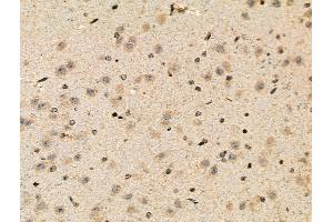 Phospho-Parkin (Ser378) Antibody at 1/100 staining Mouse brain tissue by IHC-P.