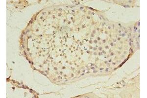 Immunohistochemistry of paraffin-embedded human testis tissue using ABIN7159638 at dilution of 1:100 (TET3 antibody  (AA 72-335))