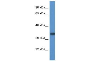 Western Blot showing ACBD6 antibody used at a concentration of 1.