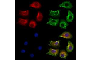 ABIN6264069 and ABIN6273289 staining Hela cells by IF/ICC. (PCMT1 antibody  (Internal Region))