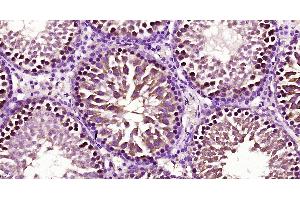 Paraformaldehyde-fixed, paraffin embedded Rat testis; Antigen retrieval by boiling in sodium citrate buffer (pH6. (FBXO15 antibody  (AA 101-200))