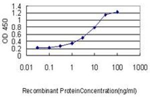 Detection limit for recombinant GST tagged CMTM5 is approximately 0. (CMTM5 antibody  (AA 1-156))