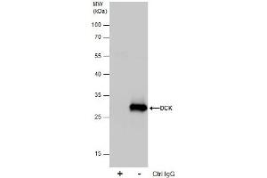 IP Image Immunoprecipitation of DCK protein from 293T whole cell extracts using 5 μg of DCK antibody, Western blot analysis was performed using DCK antibody, EasyBlot anti-Rabbit IgG  was used as a secondary reagent. (DCK antibody  (Center))