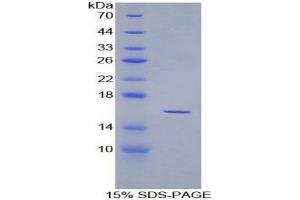 SDS-PAGE analysis of Rat Osteoglycin Protein. (OGN Protein)