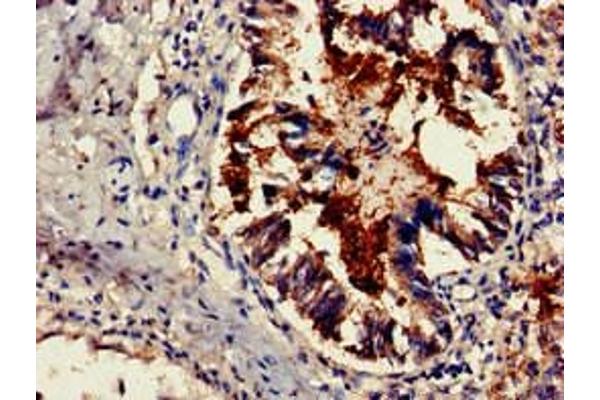 TSR2 antibody  (AA 1-191)