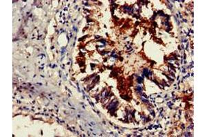 Immunohistochemistry of paraffin-embedded human lung tissue using ABIN7164202 at dilution of 1:100 (TSR2 antibody  (AA 1-191))