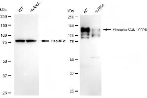 Western blotting analysis using phospho-CBL (Y774) antibody (ABIN7797878). (Recombinant CBL antibody  (pTyr774))