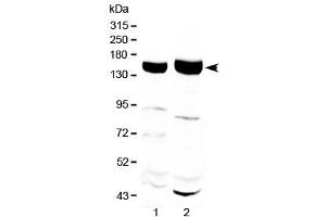 Western blot testing of 1) rat liver and 2) mouse liver with Xanthine Oxidase antibody at 0.