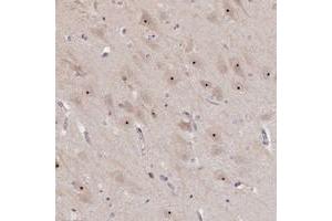 Immunohistochemical staining of human hippocampus with MGA polyclonal antibody  shows nucleolar positivity in neuronal cells at 1:500-1:1000 dilution. (MGA antibody)