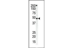 GRK1 antibody  (C-Term)