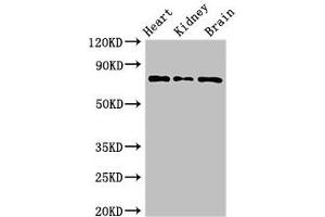 Western Blot Positive WB detected in: Mouse heart tissue, Mouse kidney tissue, Mouse brain tissue All lanes: OVGP1 antibody at 3 μg/mL Secondary Goat polyclonal to rabbit IgG at 1/50000 dilution Predicted band size: 76 kDa Observed band size: 76 kDa (OVGP1 antibody  (AA 484-678))
