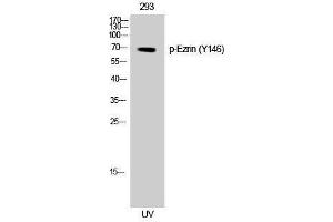 Western Blotting (WB) image for anti-Ezrin (EZR) (pTyr146) antibody (ABIN3182305)