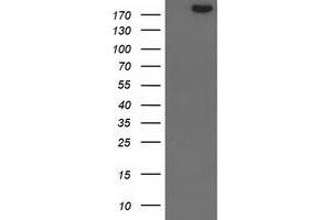 Image no. 1 for anti-SNF2 Histone Linker PHD RING Helicase, E3 Ubiquitin Protein Ligase (SHPRH) (AA 1-100), (AA 1500-1600) antibody (ABIN1490556) (SHPRH antibody  (AA 1-100, AA 1500-1600))