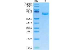 EPH Receptor A2 Protein (EPHA2) (AA 26-538) (His tag)