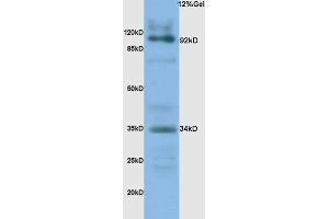 L1 human colon carcinoma lysates probed with Anti- CD138/Syndecan-1 Polyclonal Antibody, Unconjugated (ABIN674769) at 1:200 overnight at 4 °C. (Syndecan 1 antibody  (AA 201-310))