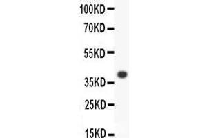 Anti-ALOX15 Picoband antibody,  All lanes: Anti-ALOX15 at 0.