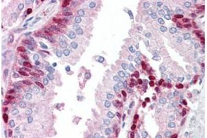 Anti-LRRFIP1 antibody IHC staining of human prostate. (LRRFIP1 antibody  (C-Term))