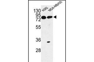 Western blot analysis of PRK Antibody (ABIN652306 and ABIN2841396) in K562, MDA-M cell line lysates (35 μg/lane).