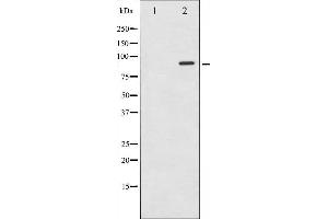 Western blot analysis of STAT6 expression in HeLa whole cell lysates,The lane on the left is treated with the antigen-specific peptide. (STAT6 antibody  (Internal Region))