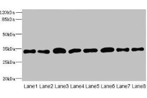 Western blot All lanes: TMBIM1 antibody at 8 μg/mL Lane 1: U251 whole cell lysate Lane 2: K562 whole cell lysate Lane 3: A549 whole cell lysate Lane 4: MCF-7 whole cell lysate Lane 5: Mouse lung tissue Lane 6: Mouse liver tissue Lane 7: Mouse kidney tissue Lane 8: Human placenta tissue Secondary Goat polyclonal to rabbit IgG at 1/10000 dilution Predicted band size: 35 kDa Observed band size: 35 kDa (TMBIM1 antibody  (AA 1-109))