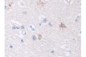 DAB staining on IHC-P; Samples: Human Cerebrum Tissue (Factor VIII antibody  (AA 1887-2044))