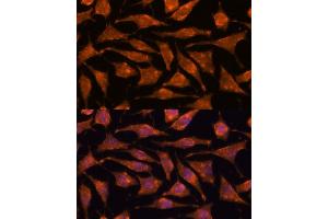 Immunofluorescence analysis of L929 cells using  antibody (ABIN7265356) at dilution of 1:100. (ABHD4 antibody  (AA 223-342))