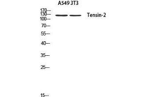 Western Blot (WB) analysis of A549 3T3 using Tensin-2 antibody.