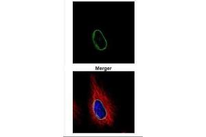 ICC/IF Image Confocal immunofluorescence analysis (Olympus FV10i) of methanol-fixed HeLa, using POM121, antibody (Green) at 1:500 dilution. (POM121 antibody  (N-Term))