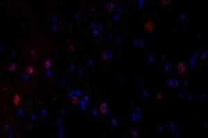 Immunofluorescence (fixed cells) (IF/ICC) image for anti-Growth Differentiation Factor 6 (GDF6) antibody (ABIN7074132)