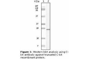 Image no. 1 for anti-Mast/stem Cell Growth Factor Receptor (KIT) antibody (ABIN232128) (KIT antibody)