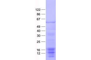 Validation with Western Blot (GORASP2 Protein (His tag))