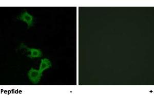 Immunofluorescence analysis of MCF-7 cells, using DAB1 polyclonal antibody . (DAB1 antibody)